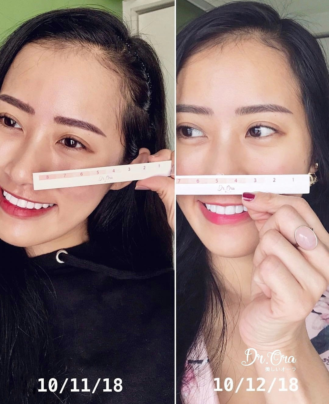 Dr Ora AURA WHITE ULTRA